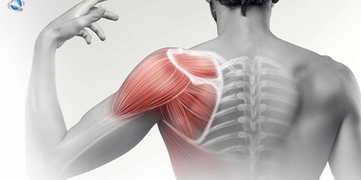 Most Common Injuries Attributed to Rotator Cuff