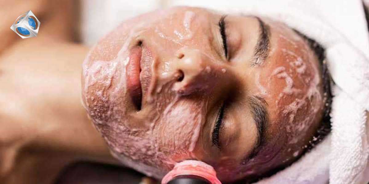 Get Rid of Hyperpigmentation at Revive Beauty Solutions