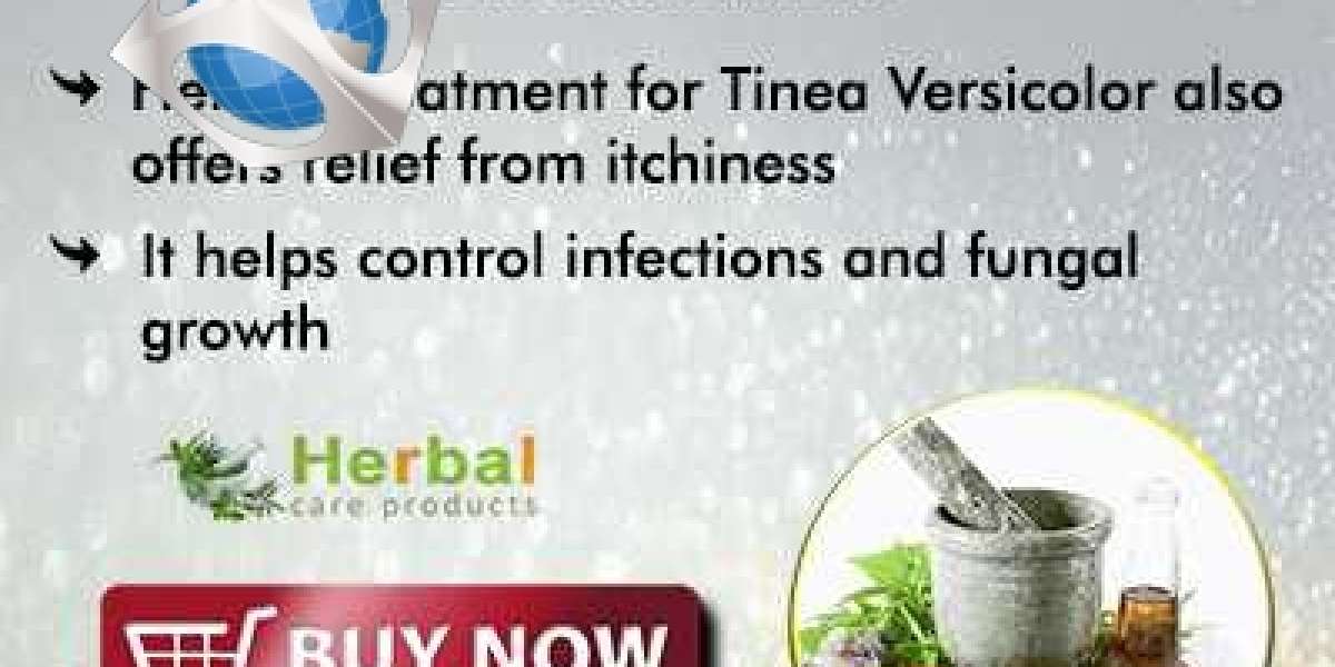 Herbal Supplement for Tinea Versicolor