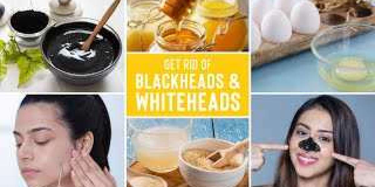 Home Care to Reduce Blackheads