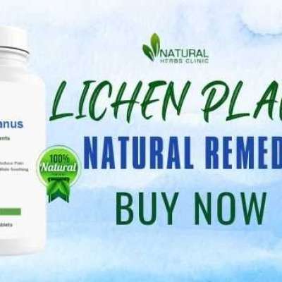 Use Herbal Remedies to Stop Lichen Planus Symptoms from Spreading Profile Picture