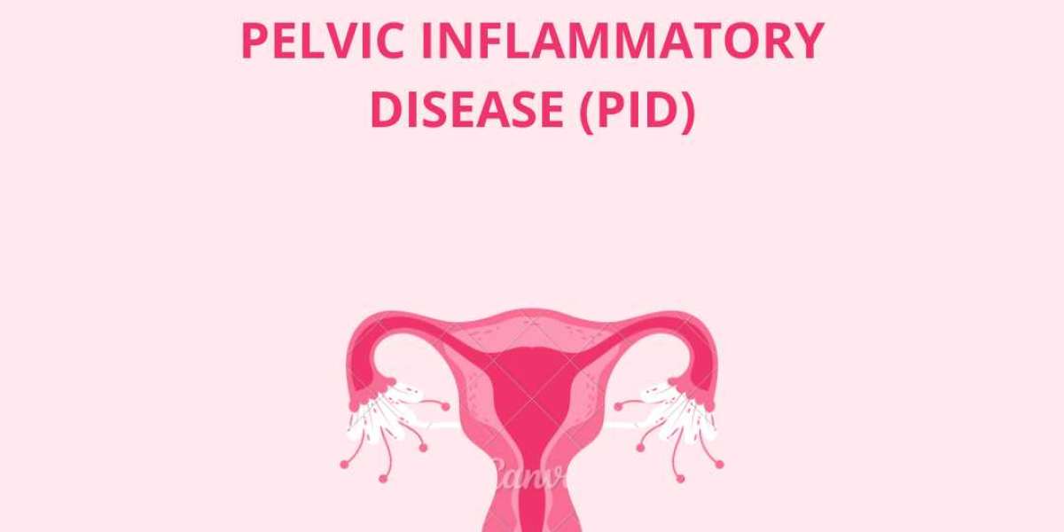 Pelvic fiery sickness (PID)- A complete guide