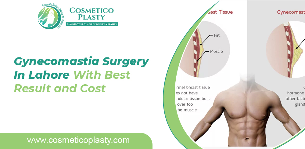 Gynecomastia Surgery in Lahore - Cost of Gynecomastia Treatment