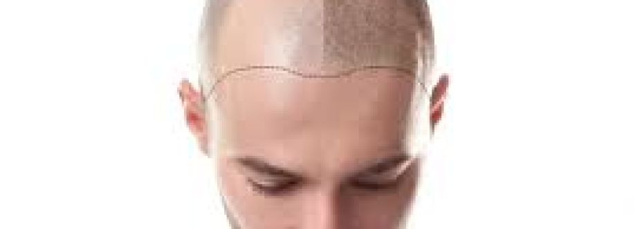 Scalp Ink Cover Image
