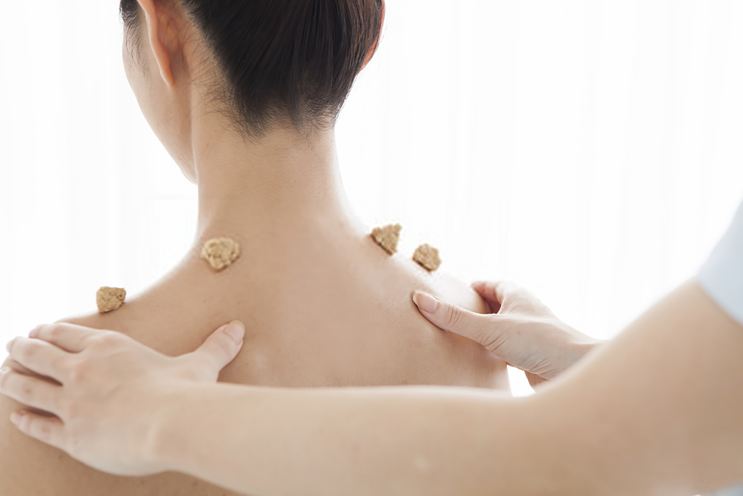 Moxibustion and Acupuncture for Stress Relief in Tao Acupuncture