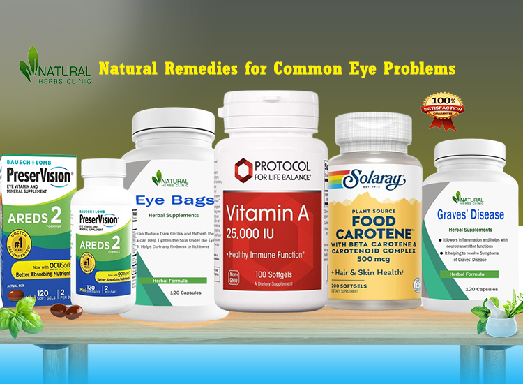 10 Natural Remedies for Common Eye Problems