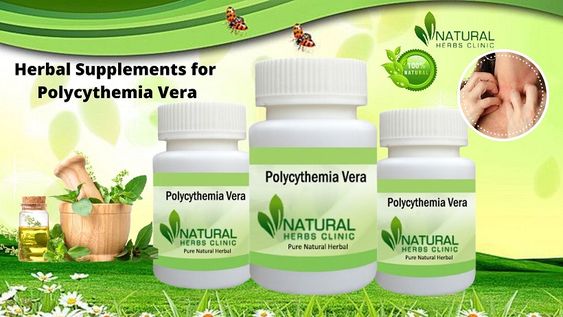 The Treatment for Polycythemia Vera Can Include - Dubai Entertainment