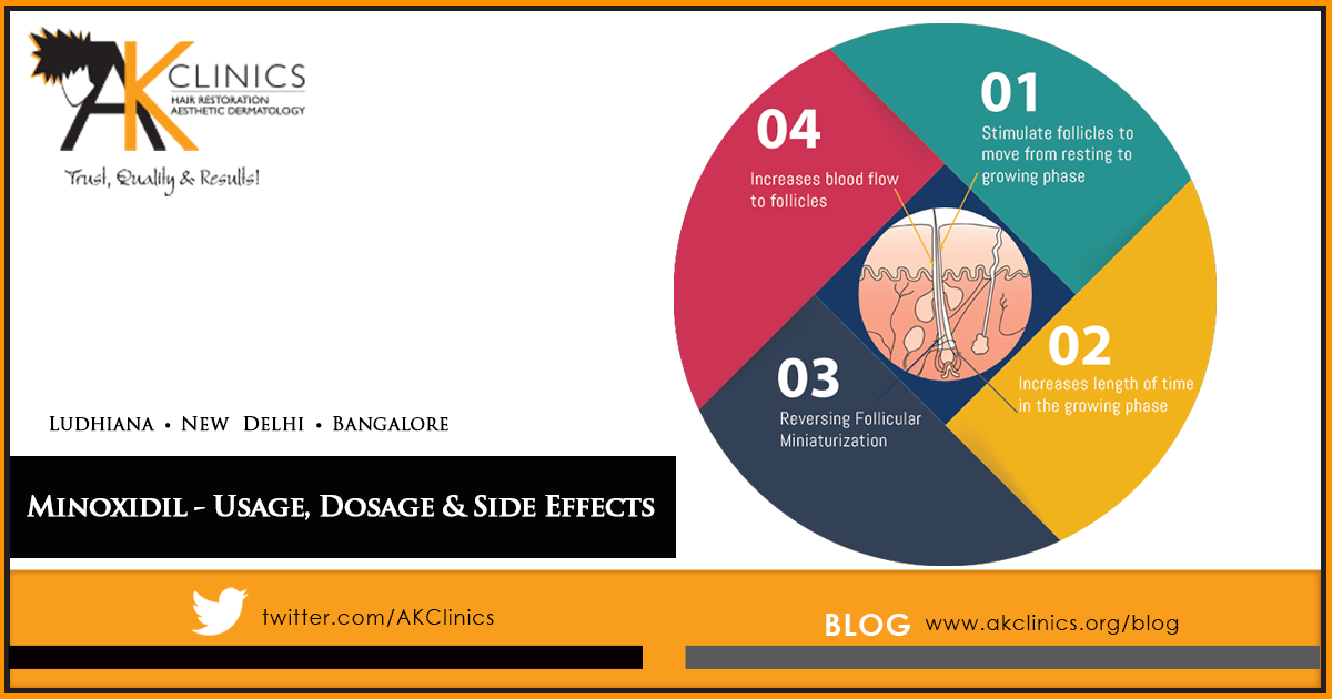 Minoxidil: Uses, Dosage, Precautions & Side effects for hair loss