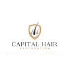 Capital Hair Restoration Hair Transplant Profile Picture