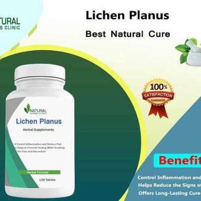 Lichen Planus Natural Treatment: Reclaim Your Skin Health Profile Picture