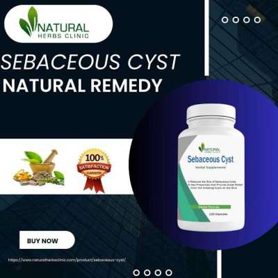 Infected Sebaceous Cyst Removal: Fast & Painless Solution - Buy Now Profile Picture