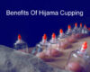 Exploring TheHealing Benefits of Hijama Cupping Therapy