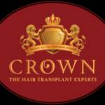 Crown Hair Transplant Experts Profile Picture