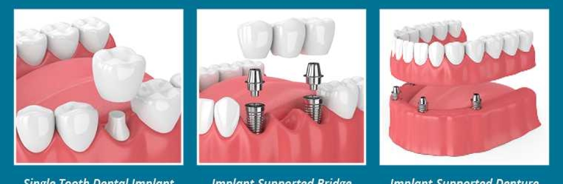 dentistsantaclarita Cover Image